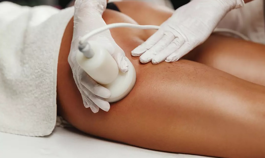 lipo cavitation